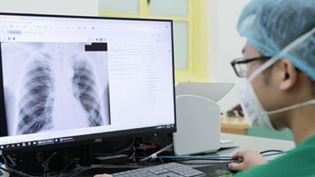 Bộ Y tế phản hồi việc từ chối thanh toán bảo hiểm y tế khi chụp X-quang dưới 6 phút